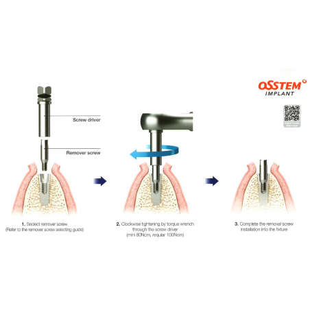 TRUSA EFR KIT COMPLETA EXTRACTIE IMPLANTURI OSSTEM  OSFRFK
