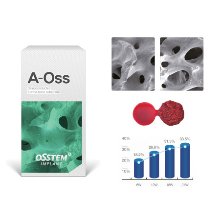 A OSS BOVIN OSSTEM 1g (1.00-2.00 mm)  BAL10