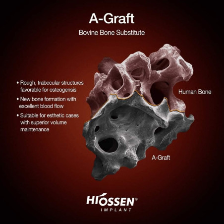 A OSS BOVIN OSSTEM 1g (1.00-2.00 mm)  BAL10