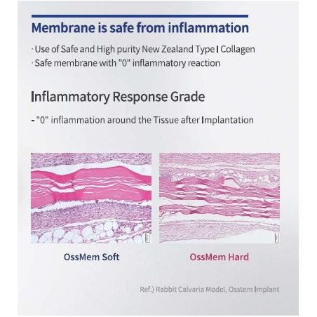 MEMBRANA COLAGEN HARD OSSTEM 15X20  OCMH1520