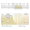 Cercon disk 98 XTML A1 14