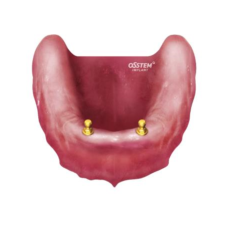 O-RING SET 5 GARNITURI N  OAON01S