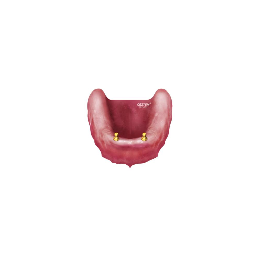 O-RING SET 5 GARNITURI N  OAON01S