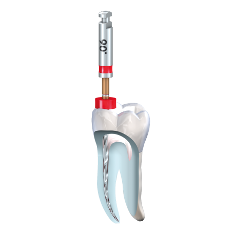 FQ ROTATIV 20/06 - 21mm