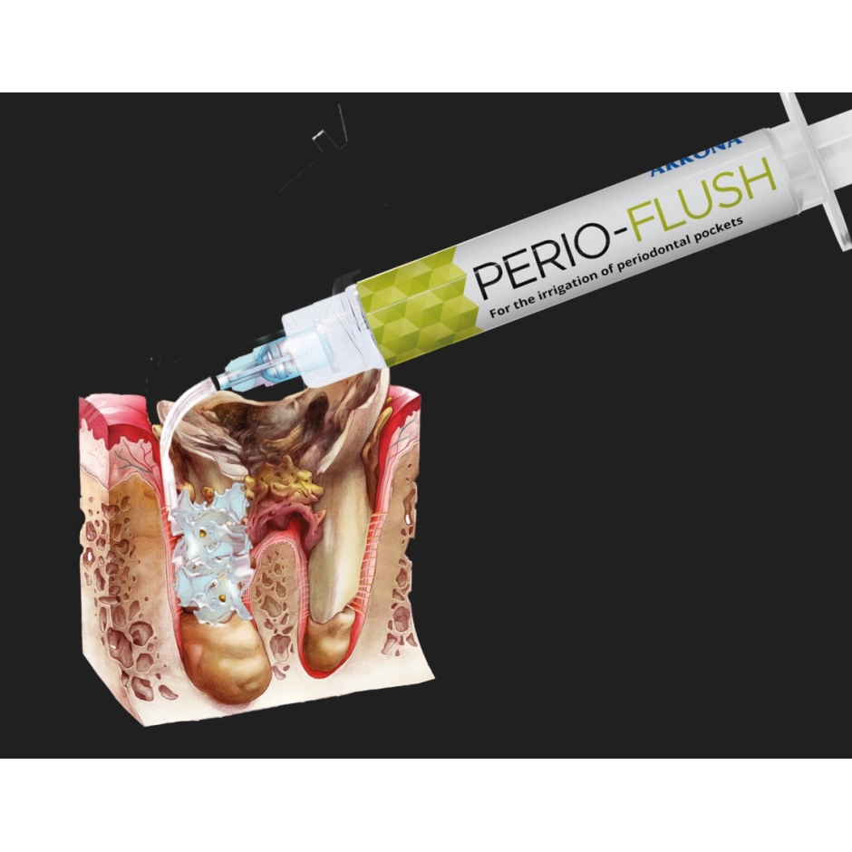 PERIOFLUSH 1x3ml