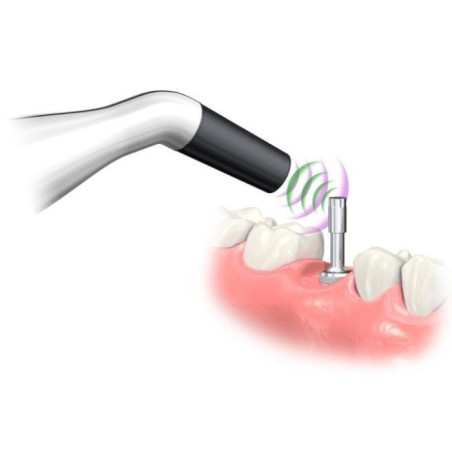 Pachet 30 Implanturi HIOSSEN +Instrument de masurat stabilitatea implantului