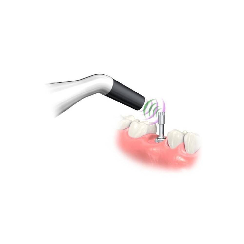 Pachet 30 Implanturi HIOSSEN +Instrument de masurat stabilitatea implantului