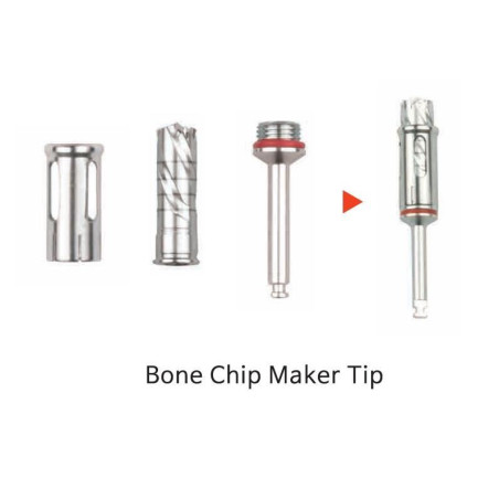 KIT COLECTARE OS MCT