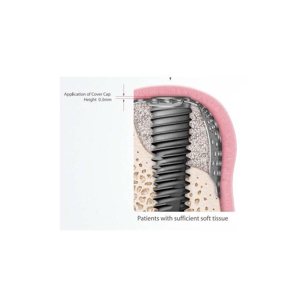 CAPA DE ACOPERIRE MEMBRANA TITAN 0.3mm TS2