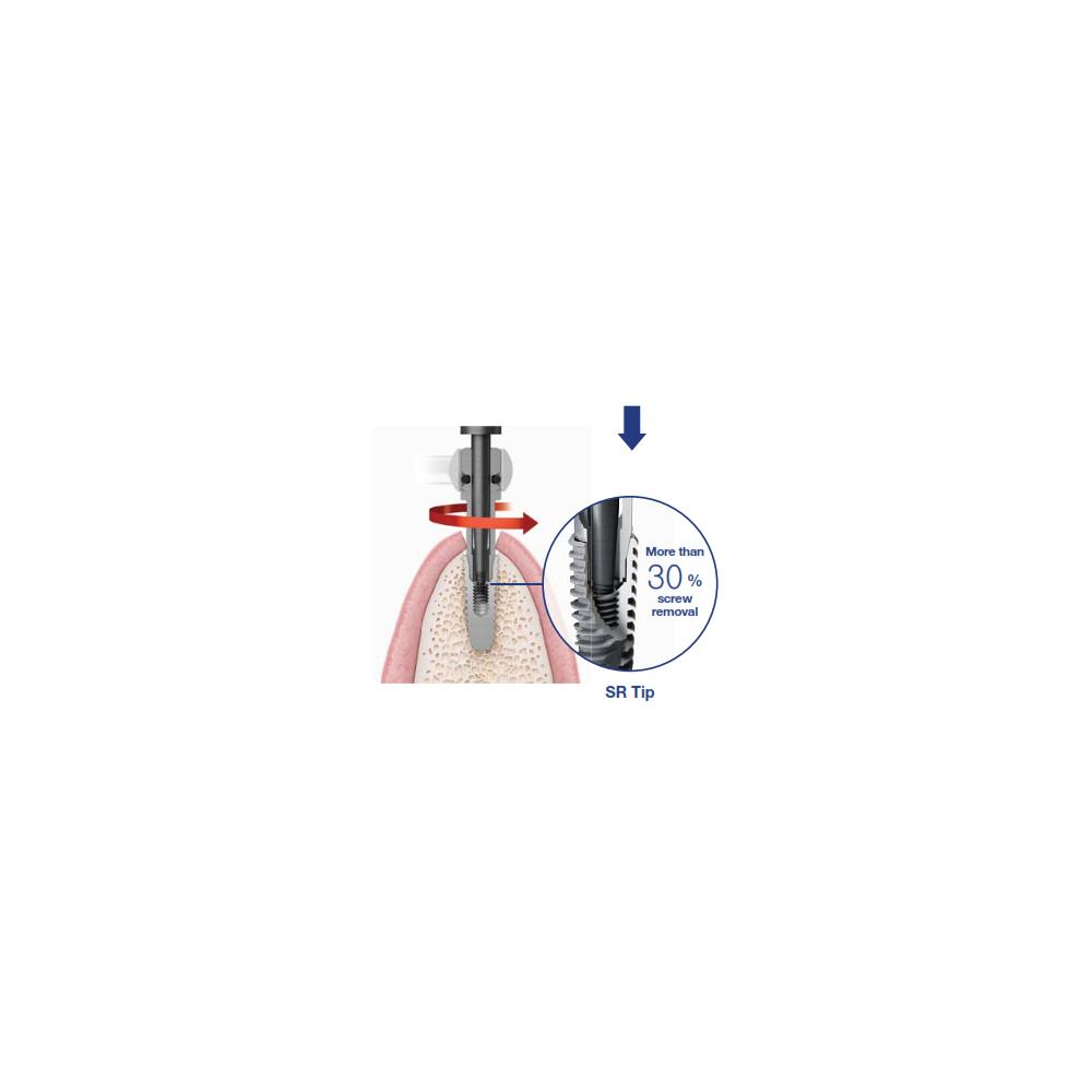 TRUSA ESR KIT PENTRU SCOATEREA BONTULUI