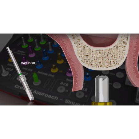 FREZA TRUSA D2.8X13 CAS KIT