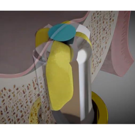 FREZA TRUSA D2.8X13 CAS KIT