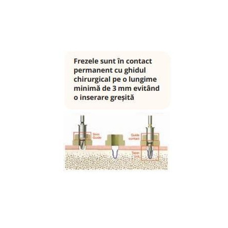 PACHET 60 X IMPLANTURI HIOSSEN SA + TRUSA CHIRURGIE GHIDATA BONUS