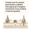 PACHET 60 X IMPLANTURI HIOSSEN SA + TRUSA CHIRURGIE GHIDATA BONUS