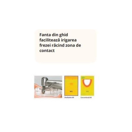 PACHET 60 X IMPLANTURI HIOSSEN SA + TRUSA CHIRURGIE GHIDATA BONUS