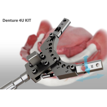 KIT DENTURE 4U ALL ON X