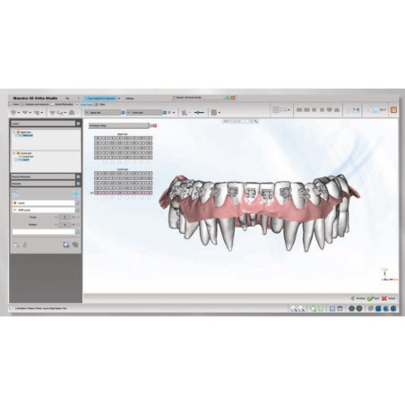 Soft brackets module