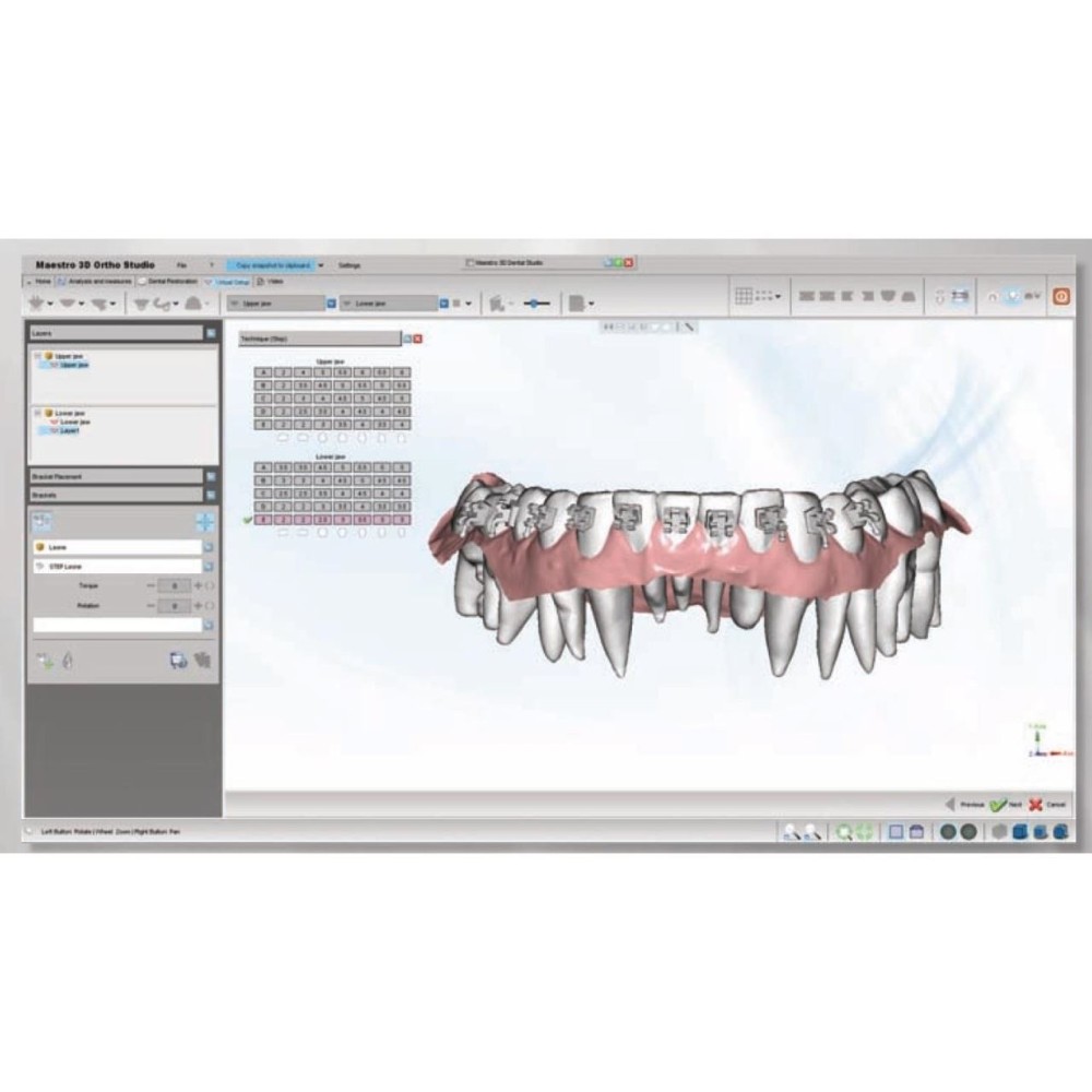 Soft brackets module