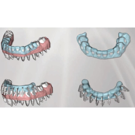 Soft clean Aligner module
