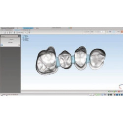 Soft Dental Restoration basic module