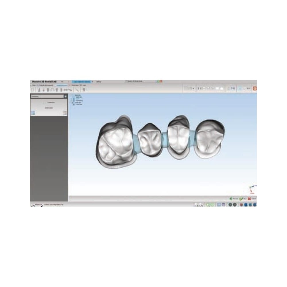 Soft Dental Restoration basic module