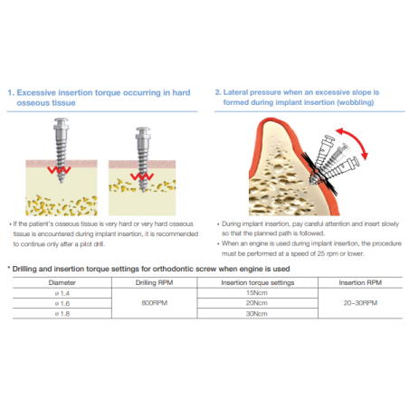ORTO IMPLANT SH 1.4x6mm  OSSH1406