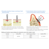 ORTO IMPLANT SH 1.4x6mm  OSSH1406