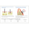 ORTO IMPLANT BH 1.6x8mm  OSBH1608