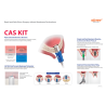 TRUSA SINUS LIFT CU ABORDARE CRESTALA CAS KIT  HCRSNK