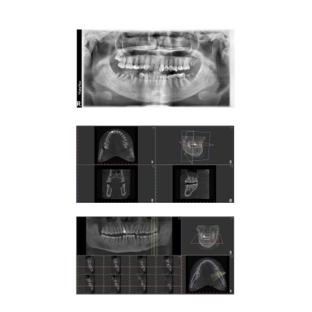 VISTAVOX S CBCT Durr Dental