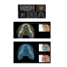 VISTAVOX S CBCT Durr Dental