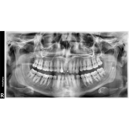 VISTAPANO S Ceph Durr Dental