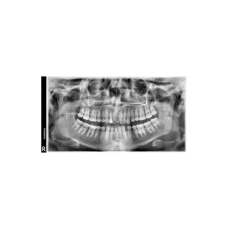 VISTAPANO S Ceph Durr Dental