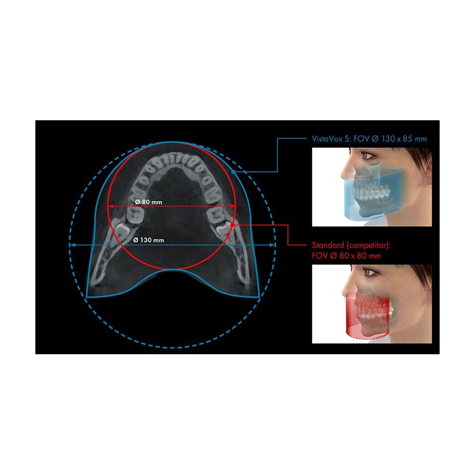 VISTAVOX S Ceph Durr Dental