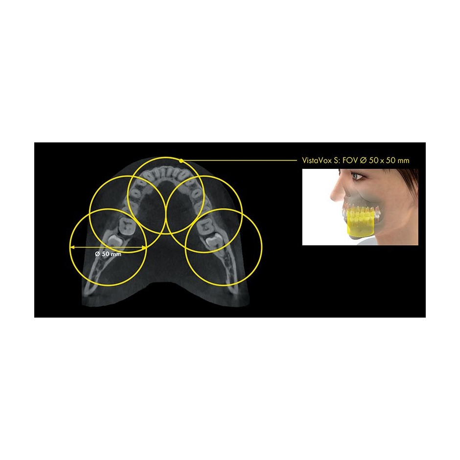 VISTAVOX S Ceph Durr Dental