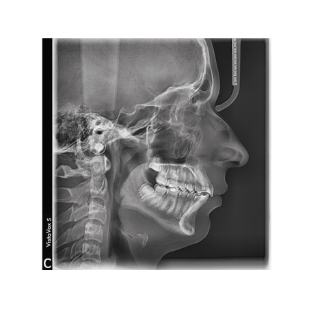 VISTAVOX S Ceph Durr Dental