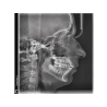 VISTAVOX S Ceph Durr Dental