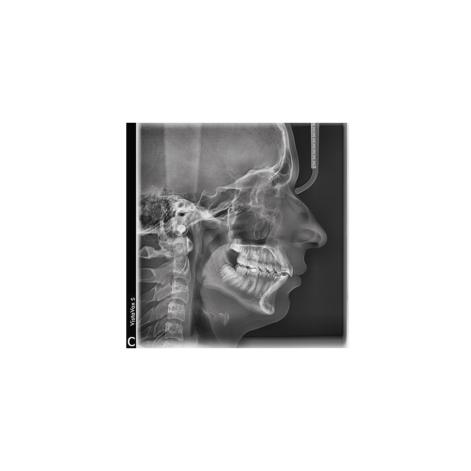 VISTAVOX S Ceph Durr Dental