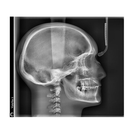 VISTAVOX S Ceph Durr Dental