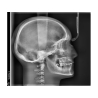 VISTAVOX S Ceph Durr Dental