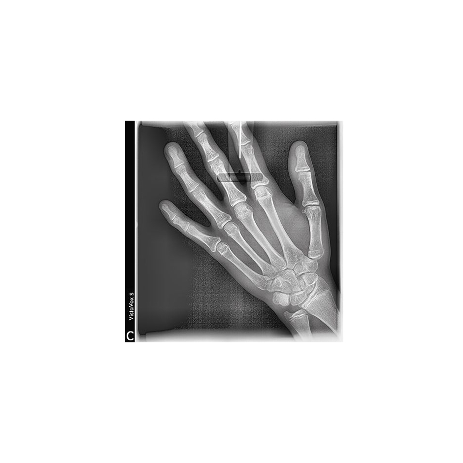 VISTAVOX S Ceph Durr Dental