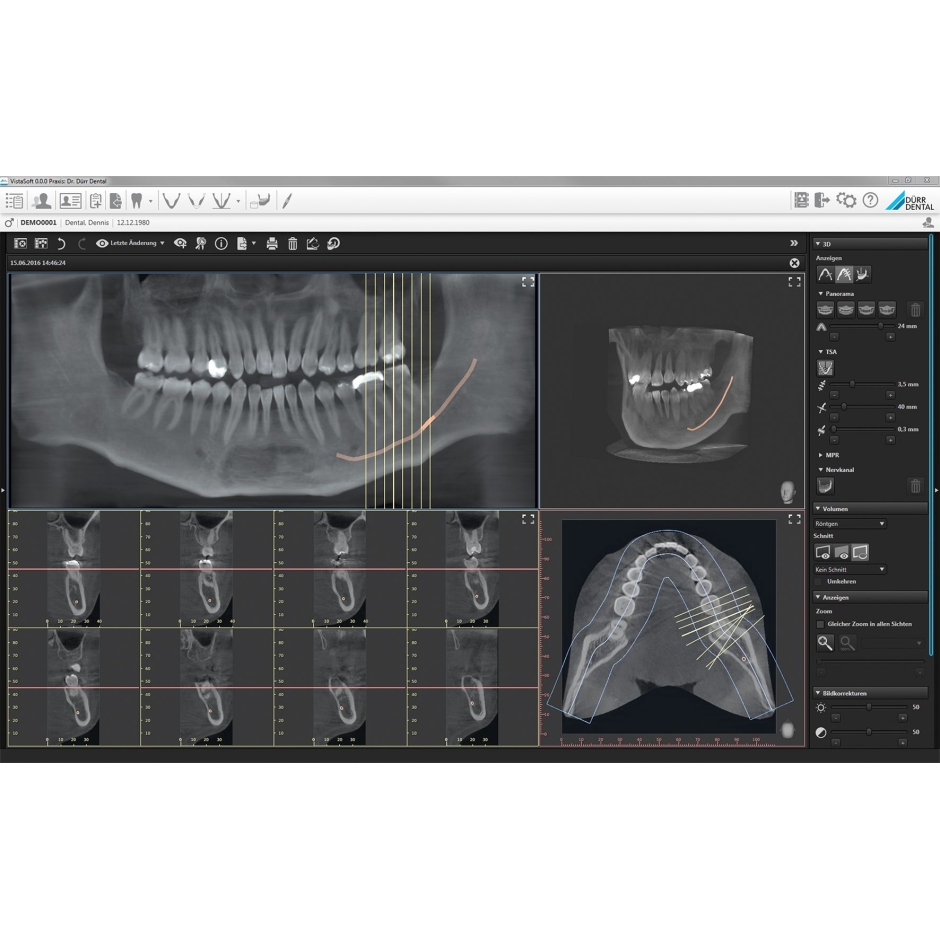 VISTAVOX S Ceph Durr Dental