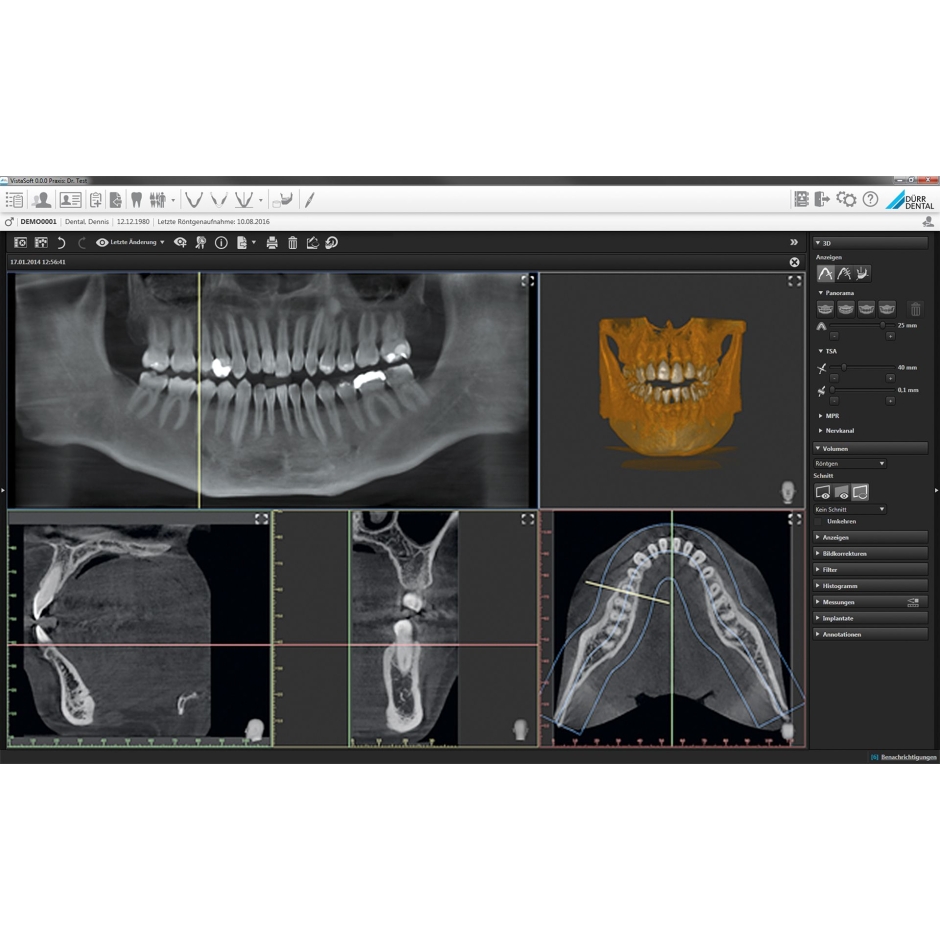 VISTAVOX S Ceph Durr Dental