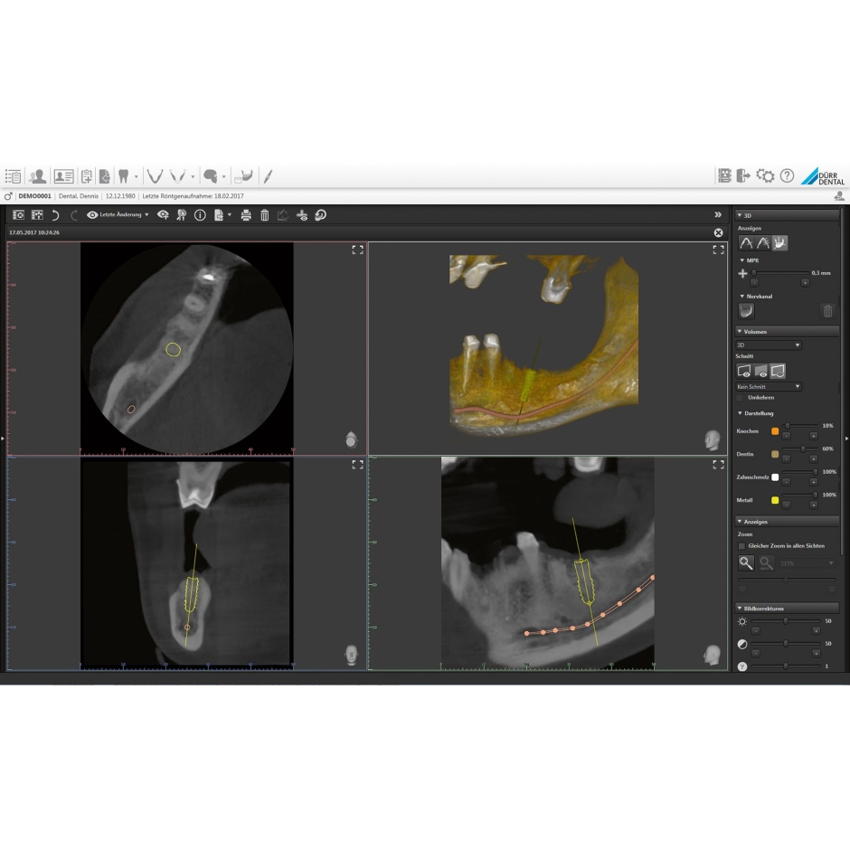 VISTAVOX S Ceph Durr Dental