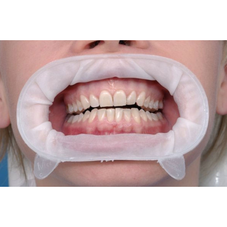 OptraGate Junior Refill