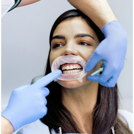 OptraGate Small Refill