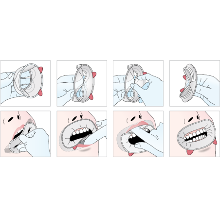 OptraGate Small Refill