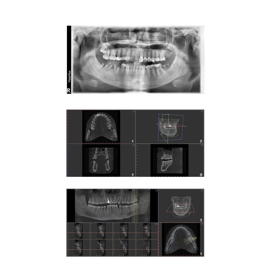 VISTAVOX S CBCT Durr Dental