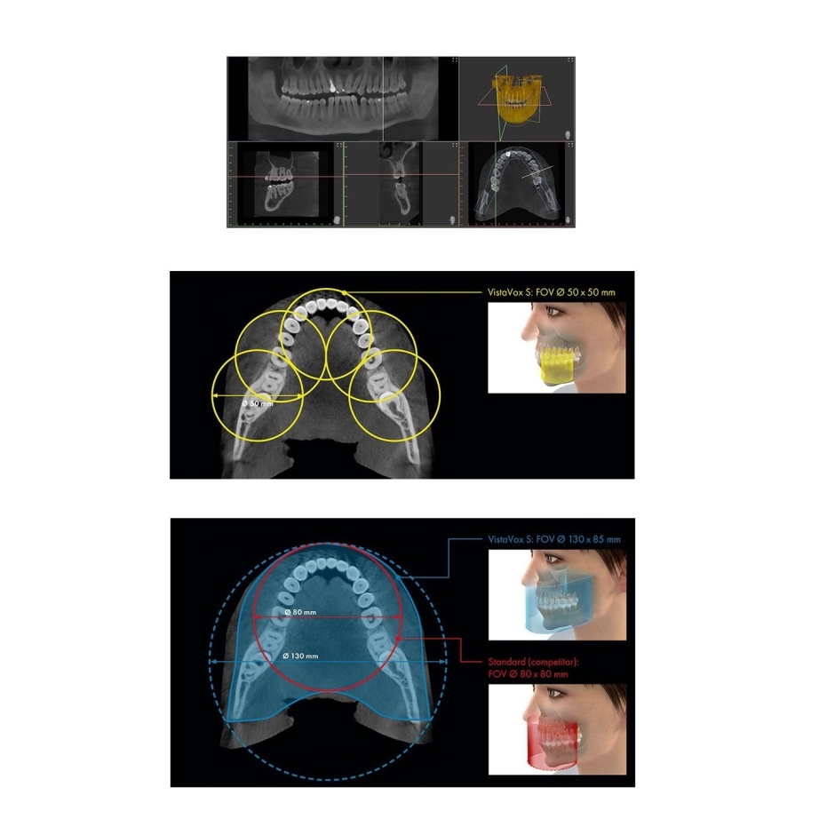 VISTAVOX S CBCT Durr Dental