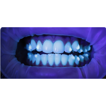 Tetric EvoCeram Aligner Refill 1x3g T